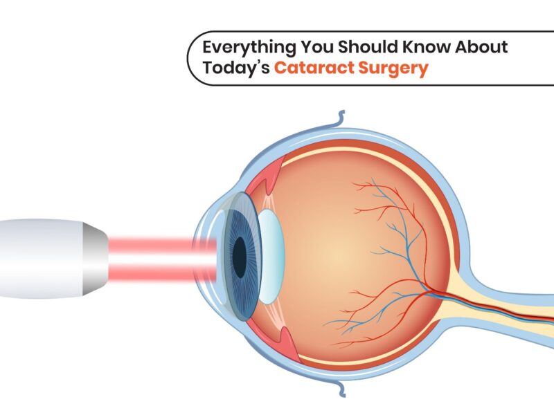 Understanding Modern Cataract Surgery