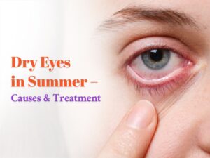 Dry Eyes in Summer – Causes & Treatment in Kukatpally, Hyderabad