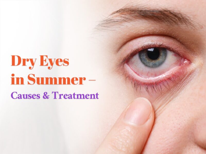 Dry Eyes in Summer – Causes & Treatment in Kukatpally, Hyderabad