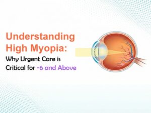 High Myopia Risks in Adults – Why –6 and Above Needs Urgent Care in Hyderabad